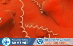 test img